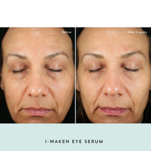 Load image into Gallery viewer, I-Waken Eye Serum
