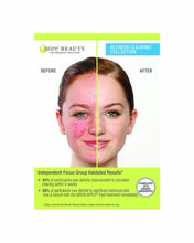 Load image into Gallery viewer, Blemish Clearing Serum
